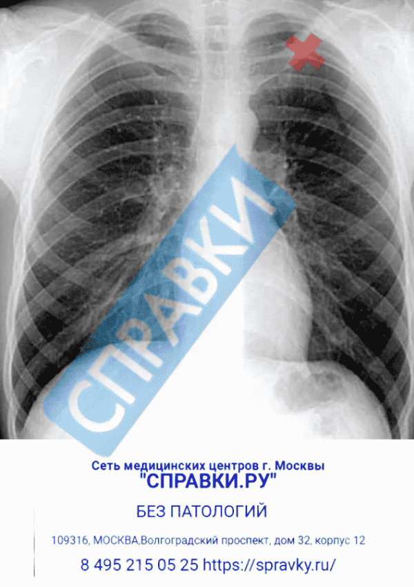 Флюорография (ФЛГ) - Справки.ру